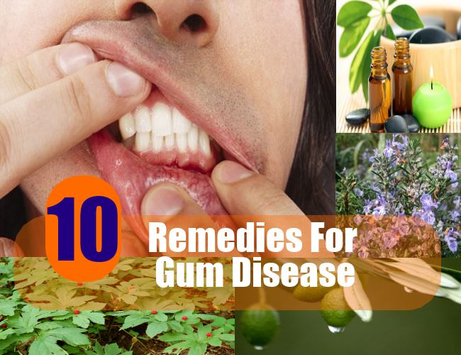 home remedies natural cure for all diseases